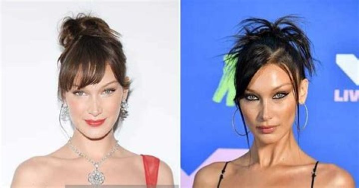 Bella Hadid, Cosmetic Surgery, Model, Gigi Hadid Bella Hadid, Cosmetic Surgery, Model, Gigi Hadid
