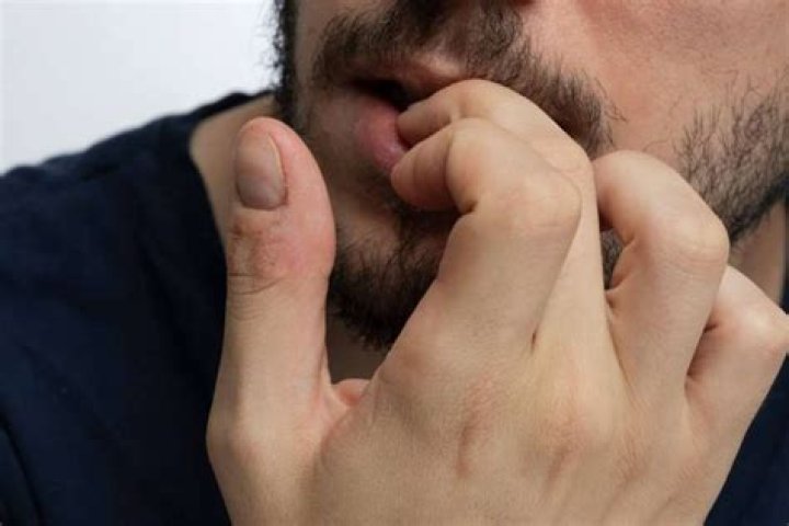 Biting nails is socially unattractive in addition to being bad for our health. Photo / Getty.