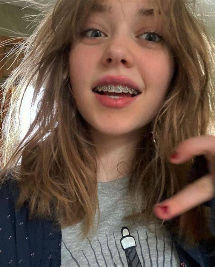 Braces Girl Video: On Reddit, Tiktok, Instagram, Youtube,& Telegram