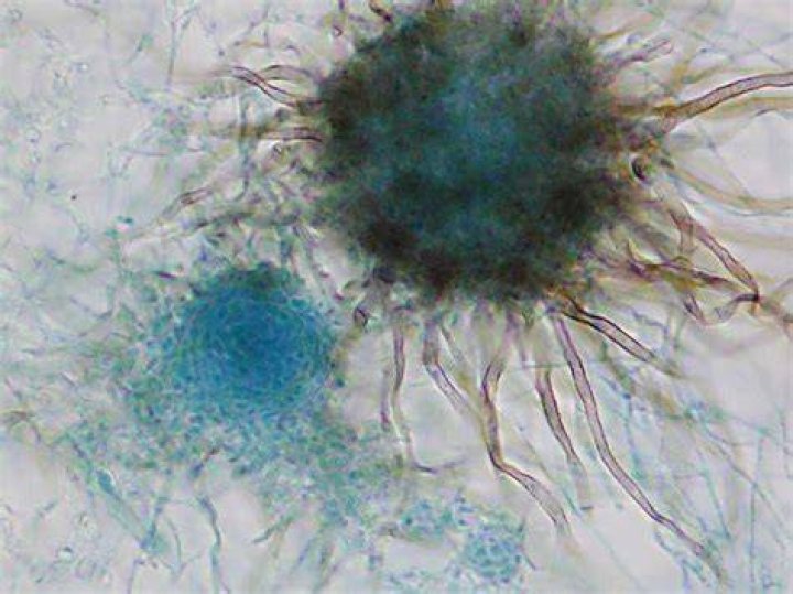 Chaetomium Mold