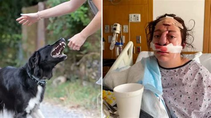 dog attacks a person