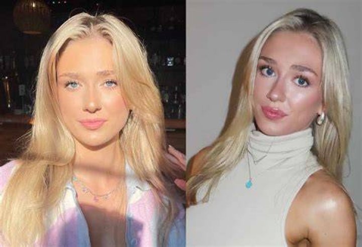 Grace Brassel told viewers to stop vaping, showing the X-ray of her lung. Photo / TikTok / gracejohanna