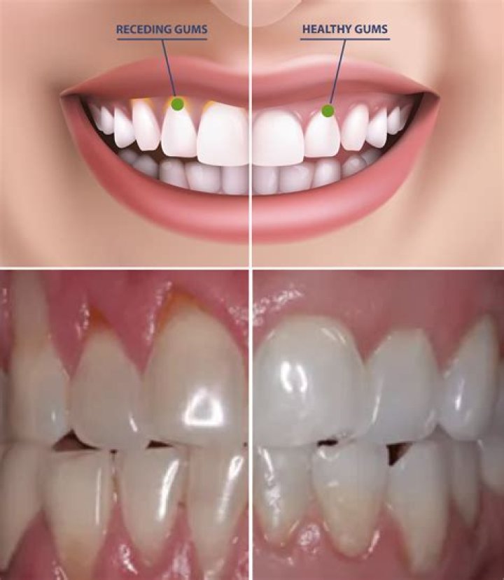 Gums in food: Are they healthy and what are they used for?