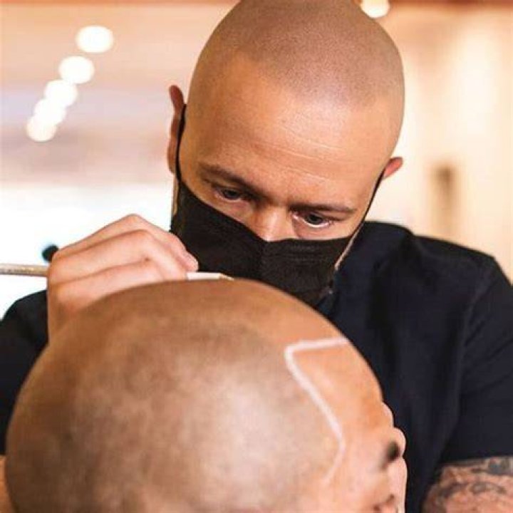 Hairline Tattooing Might Be The Hair Loss Solution You Didn’t Know Existed