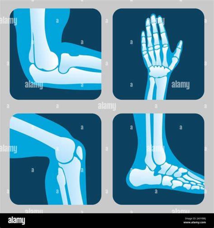 Human leg, Elbow, Style, Wrist, Waist, Knee, Sitting, Athletic dance move, Flash photography, Dancer, 