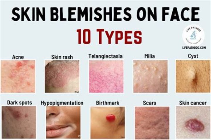 skin of woman with blemish and spots skin of woman with blemish and spots