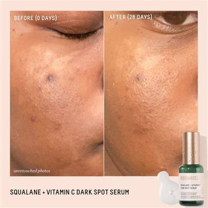 Squalane + Vitamin C Dark Spot Serum