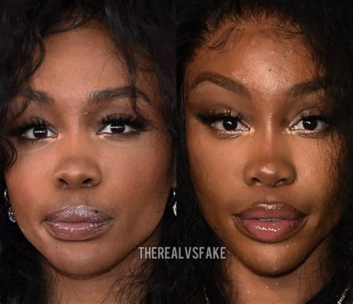 Sza Before And After Plastic Surgery Everything You Need To Know!