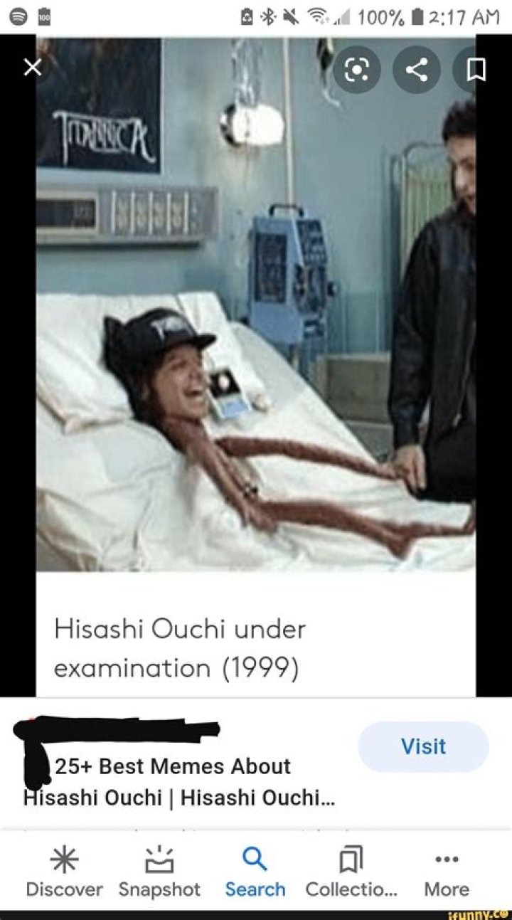 This photo of Hisachi Ouchi was taken after he survived a nuclear melt