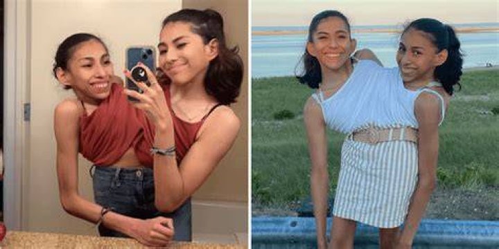 Twin sisters share everything - looks, job, boyfriend