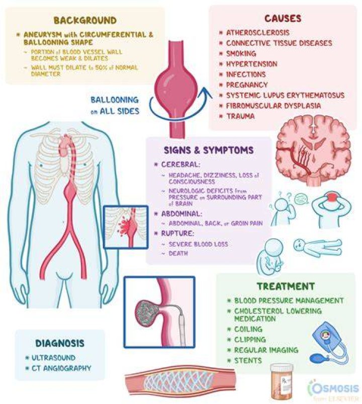 What Causes an Aneurysm